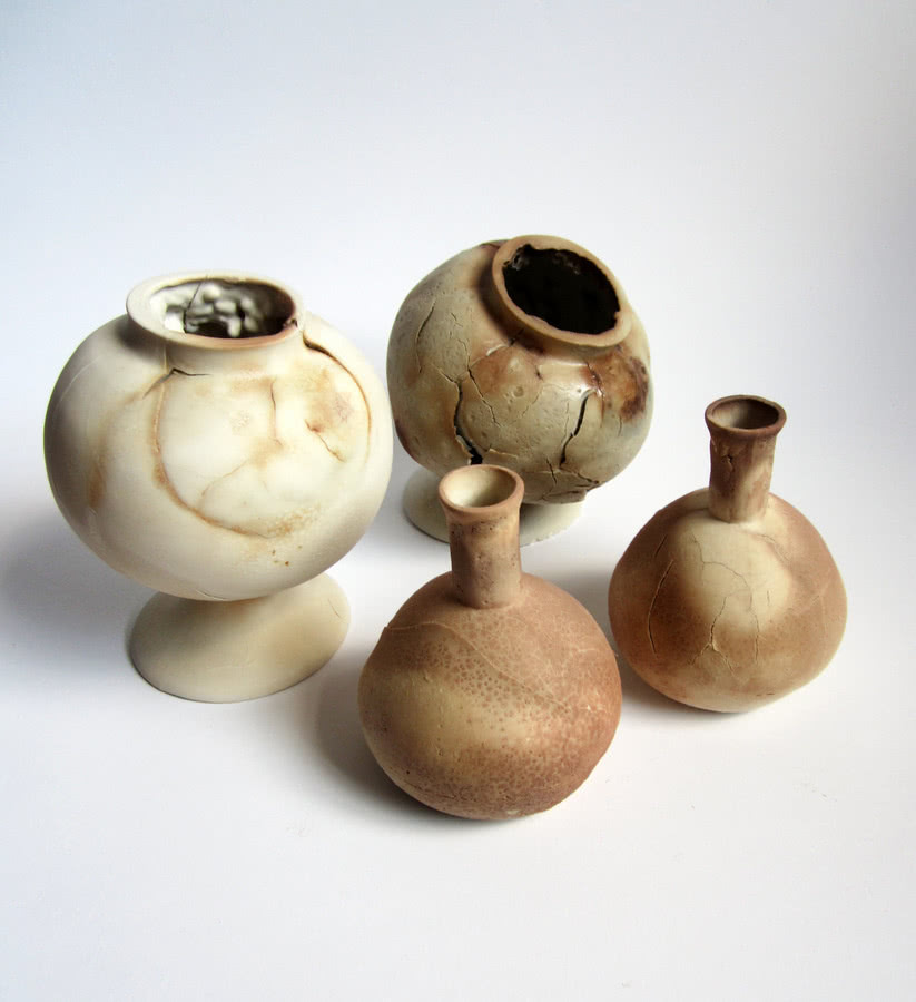 Kiła. Piętno choroby. Seria "Medyczne pamiątki"...